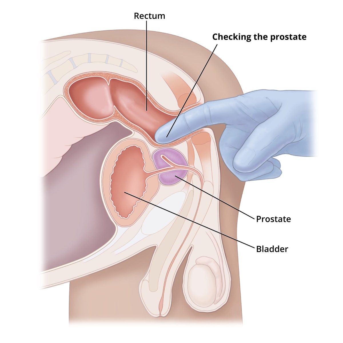 Prostate Problems and BPH Treatment